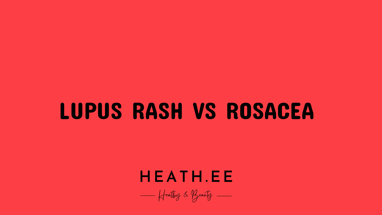 Lupus Rash Vs Rosacea Whats The Difference Heathe 