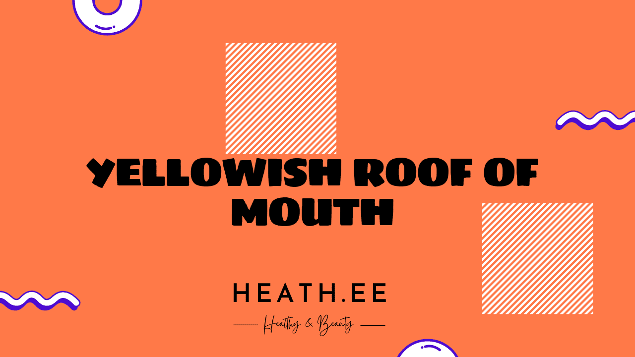 yellowish-roof-of-mouth-what-you-need-to-know-heathe