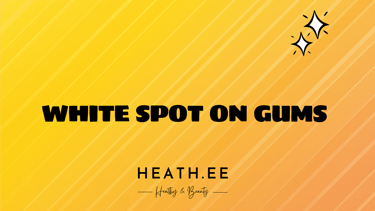 what-is-a-white-spot-on-gums-heathe