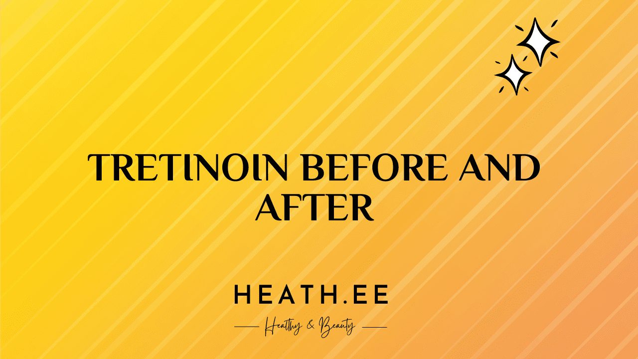 Tretinoin Before and After: A Comprehensive Guide to Skin Care - Heathe