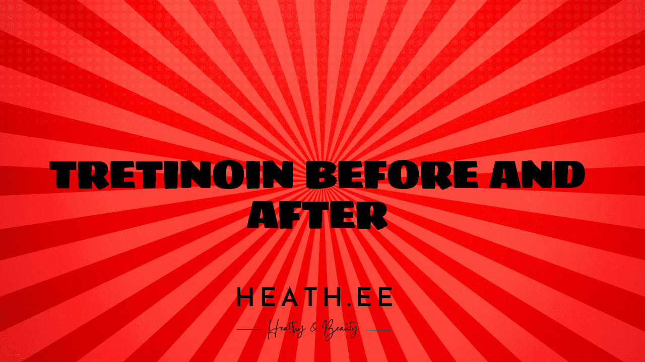 Tretinoin Before and After: A Comprehensive Guide to Skin Care - Heathe