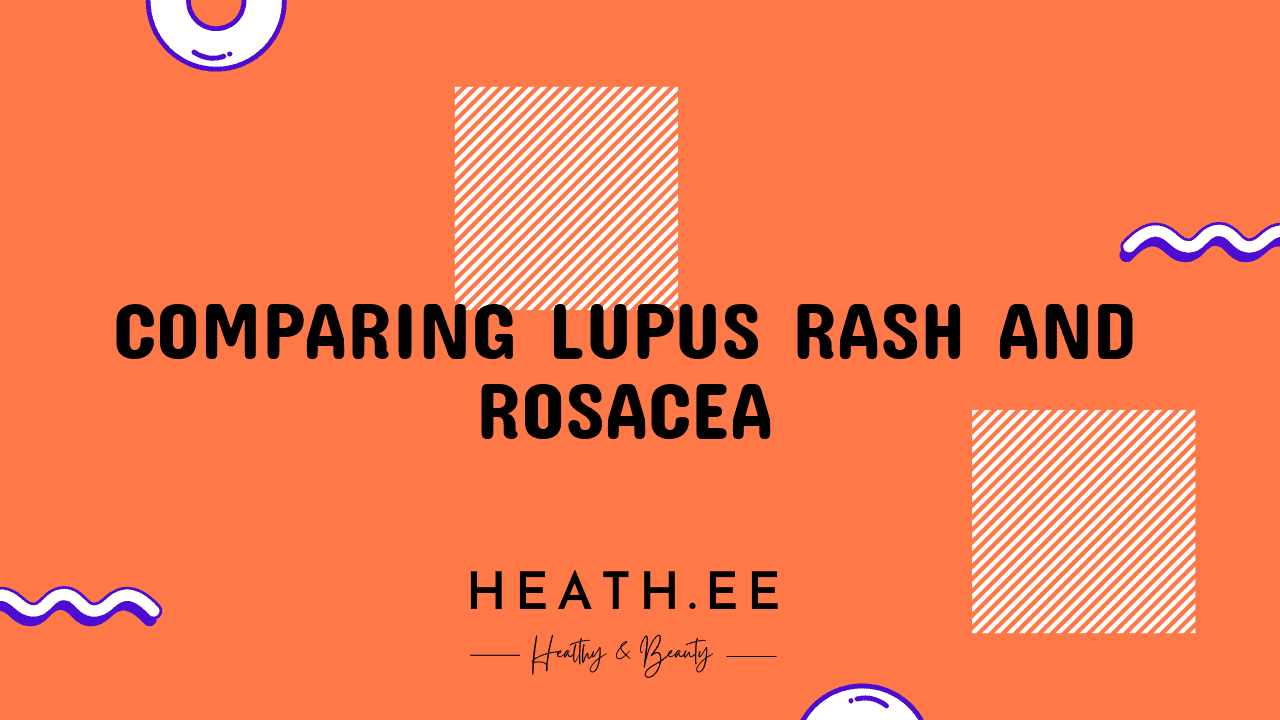 Lupus Rash Vs Rosacea Whats The Difference Heathe 