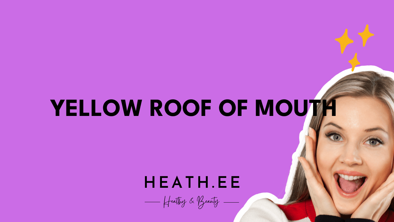 yellow-roof-of-mouth-a-comprehensive-guide-to-mouth-conditions-heathe