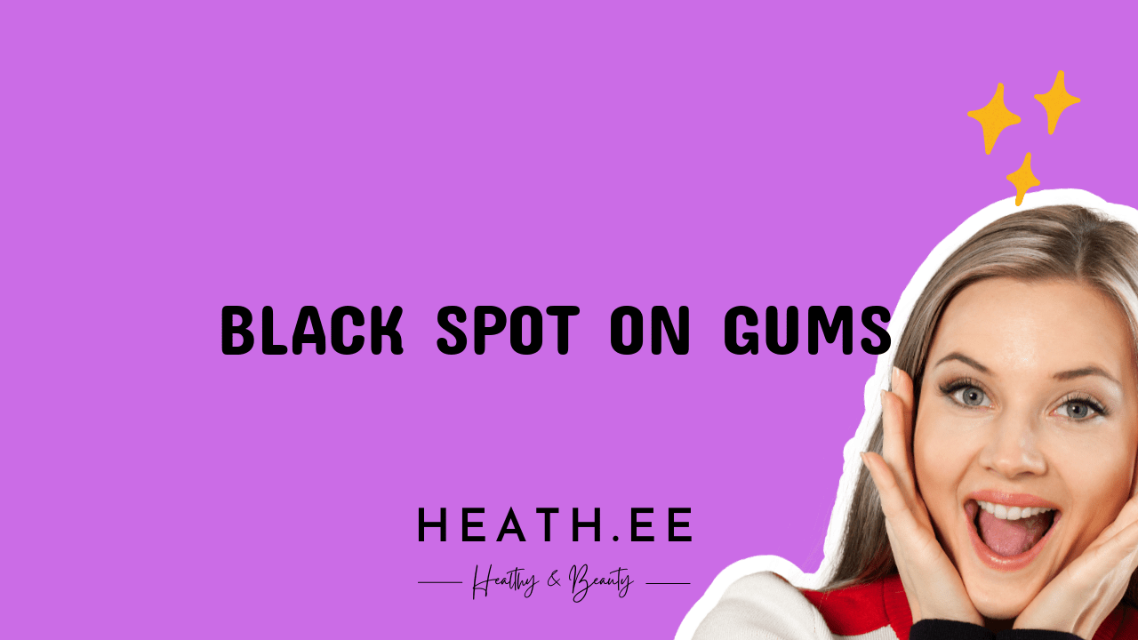 black-spot-on-gums-what-you-need-to-know-heathe